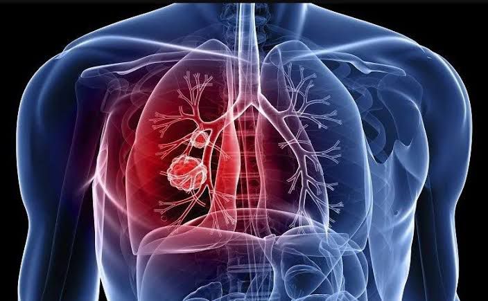 Câmara de Limeira terá campanha anual sobre prevenção e combate à Hipertensão Pulmonar