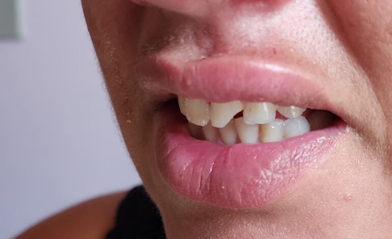 GCM prende homem acusado de agredir ex-companheira no bairro Boa Esperança, em Limeira